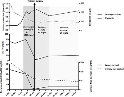 Case Report: A Challenging Localization of a Pulmonary Ectopic ACTH-Secreting Tumor in a Patient With Severe Cushing’s Syndrome